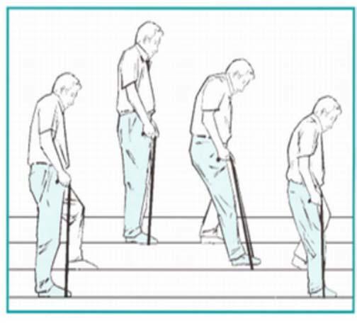 Going up stairs Stand with your crutch or stick close to the step. First, step up with your unoperated leg. Then step up with your operated leg onto the same step.