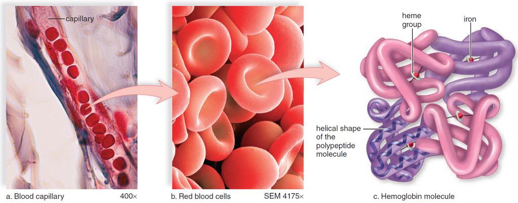 10.4 McGraw Hill 11. Anemia is a common blood disorder that results in a tired, rundown feeling.
