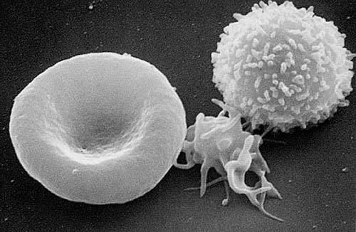 White Blood Cells Defend the body against disease Larger than red blood cells Contain nuclei Many kinds, each with different function Neutrophils take up bacteria at sites of infection and kill them