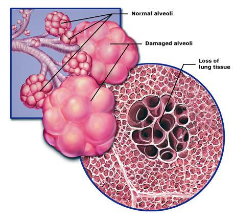 called alveoli Alveoli tiny air sacs of lungs where oxygen and carbon dioxide are exchanged Surrounded by