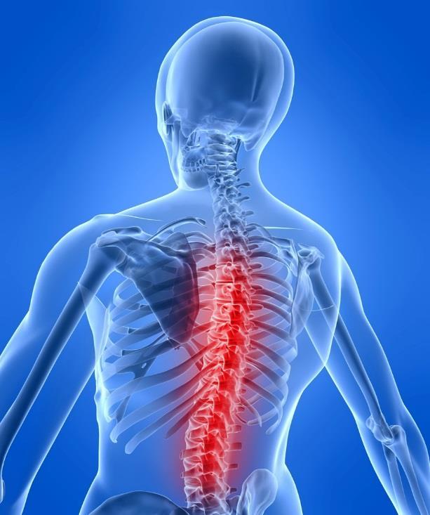 COMMON CAUSES OF BACK INJURIES Many back injuries tend to be the result of cumulative damage suffered over a long period of time.