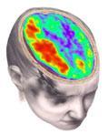 % of normal Neurometabolic Cascade Following Traumatic Brain Injury (Giza & Hovda, 2001) 500 400 Calcium 300 K+ 200 Glucose Glutamate 100 50 0 2 6