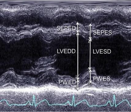 Figure 2.1 Echocardiographic M-mode image showing the measurement of left ventricular dimensions.