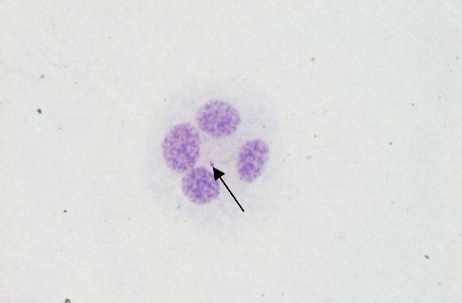 Figure 6. Sample of human blood after irradiation by 5 Gy at 400-fold magnification showing a tetranucleated cell with cytoplasm and micronucleus.