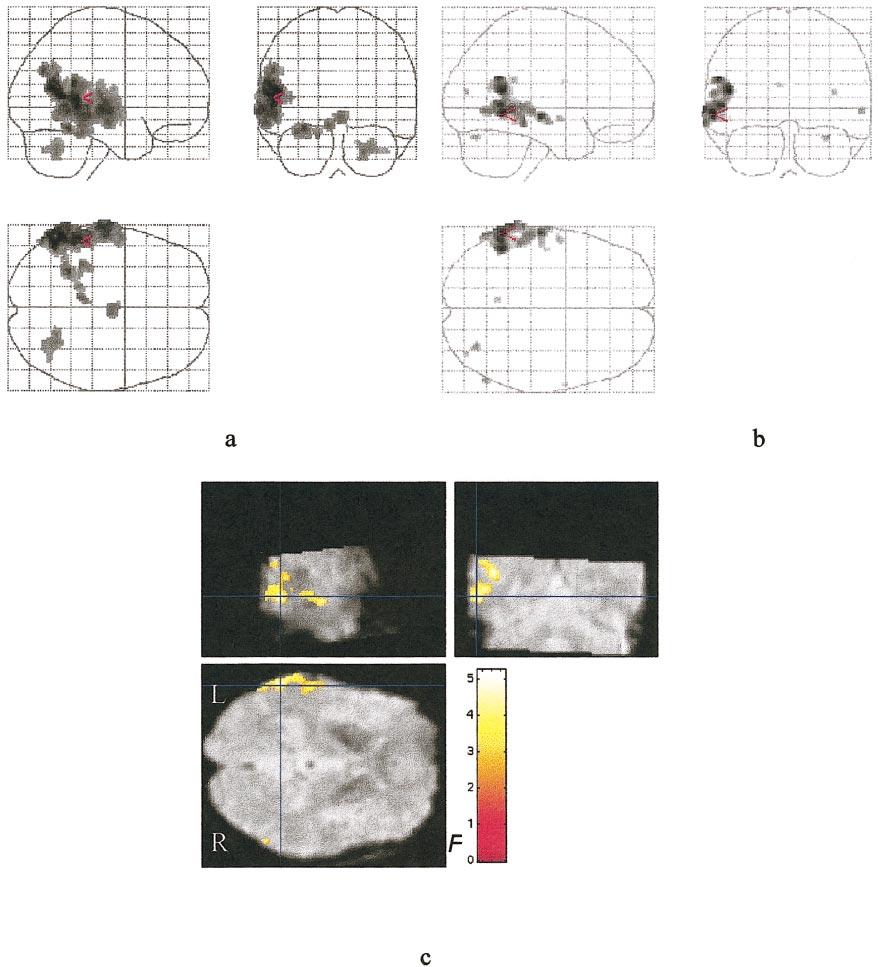 EVENT-RELATED fmri WITH SIMULTANEOUS EEG 783 FIG. 2.