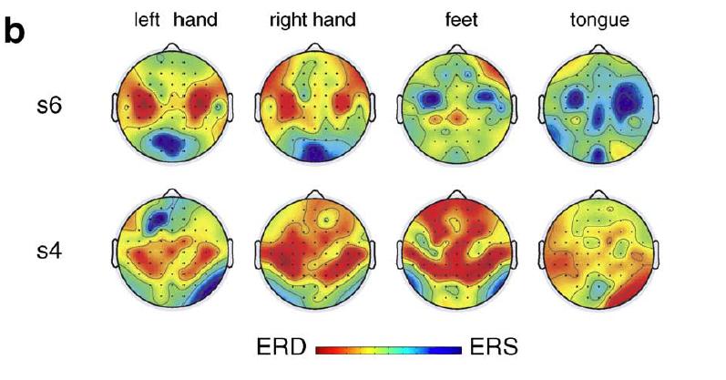 sensorimotor areas in the brain The subject can synchronize the rhythm