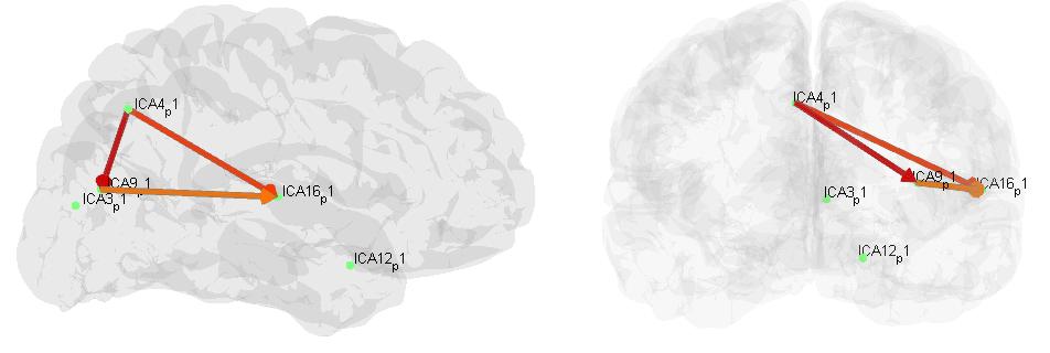 Brain Mapp 2013 -> surface