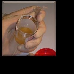 urine to the test
