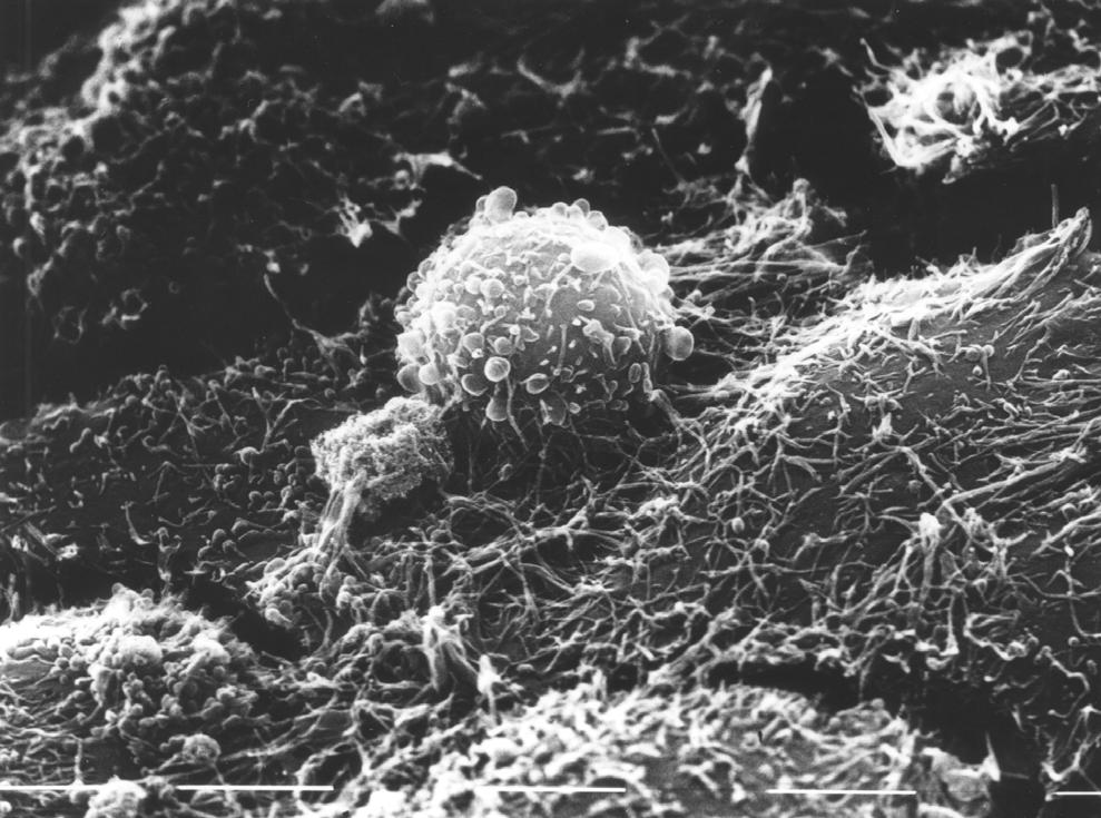 Mammary tumor cells ( MaTu) in