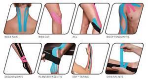Kinesiotaping CPT Assistant