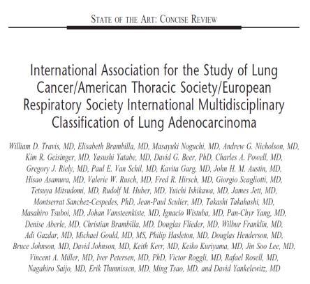 Source: Travis WD, et al. J Thorac Oncol 2011;6:244-285 IASLC / ATS / ERS One adenocarcinoma marker, one squamous cell carcinoma marker and a mucin stain Source: Travis WD, et al.