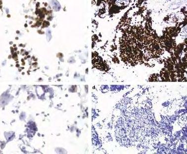 system Most small cell carcinomas