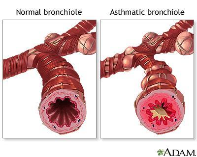 Respiratory Portion: The Bronchioles Each tertiary bronchus branches into multiple bronchioles Bronchioles branch into terminal bronchioles: One tertiary bronchus forms about 6500
