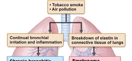 Disorders of Lower Respiratory