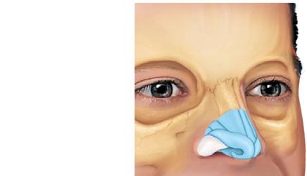 1 The Nose Provides an airway for respiration Moistens and warms air