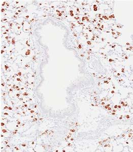 macrophages in situ Intratracheal fixation Macrophages flushed from
