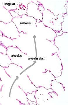 Injury Alveoli type I pneumocyte alveolar macrophage