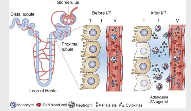 which the spaces between the kidney tubules