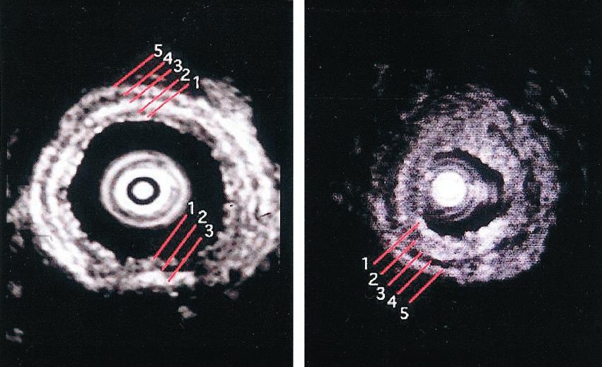 histopathologic finding showed a hole in the cartilage (black arrow), indicating that the outermost hypoechoic layer was the cartilage (bottom: hematoxylin-eosin, original 15).