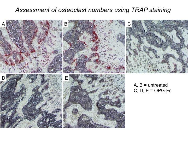 Supplemental Figure 3.1 Administration of a single dose of 100 µg OPG-Fc is sufficient to ablate osteoclasts.