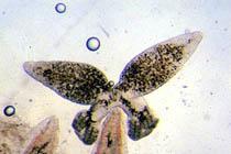 Sample Platyhelminthes Diplozoon paradoxum (Monogenea) Taenia saginata (Cestoda)