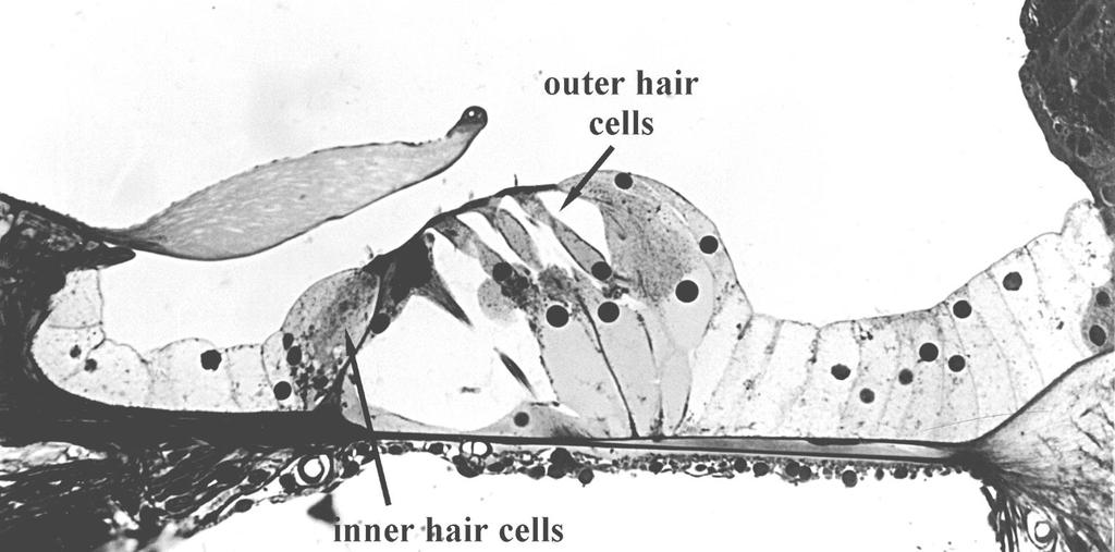 Organ of Corti Organ of Corti consists of a sensory epithelium with two types of hair cells and supporting cells Stria