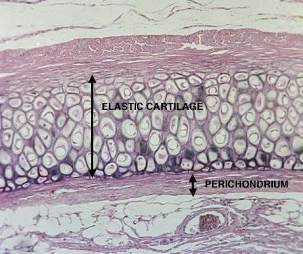 Cartilage 1) characteristics Avascular & No innervation Chondroblast vs.