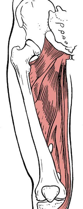 The hip external rotators include the iliopsoas, gluteus maximus, biceps femoris