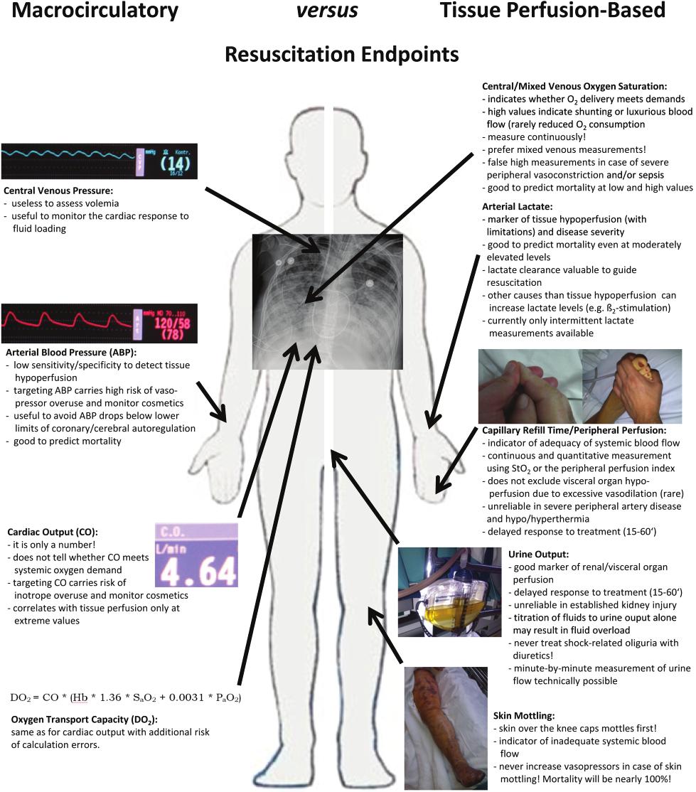 Page 5 of 7 Figure 4. Bedside considerations of macrocirculatory versus tissue perfusion-based resuscitation endpoints.