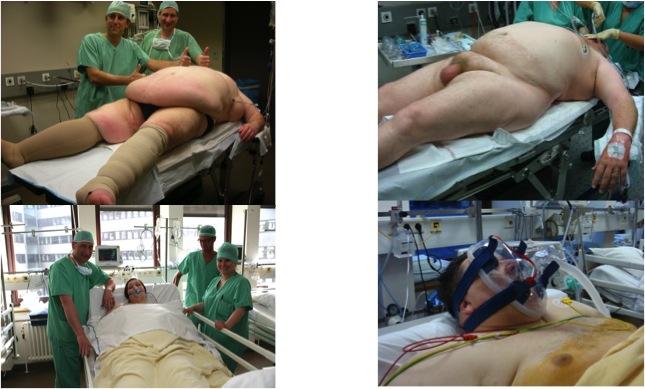 The obese patient is a challenge for anaesthesia if