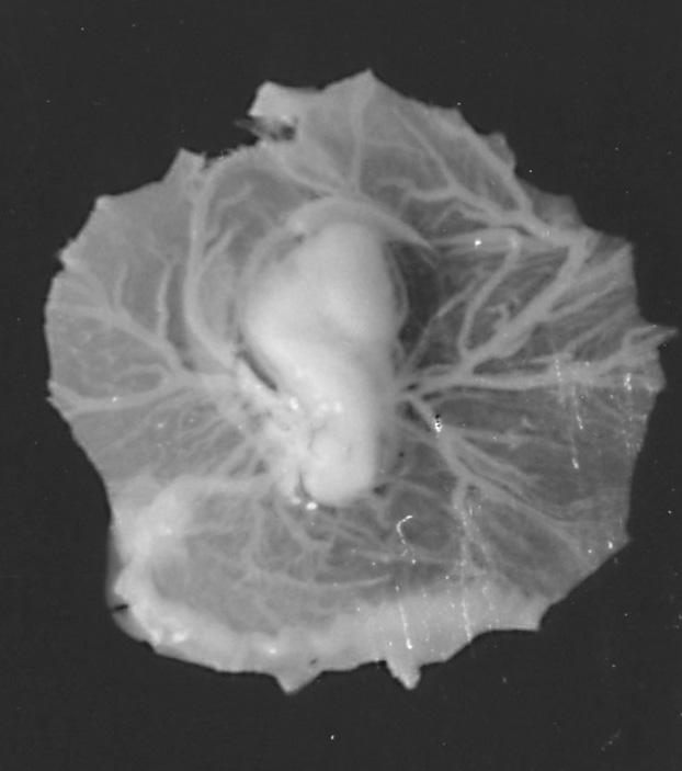 of incubation showing Terata. Fig.
