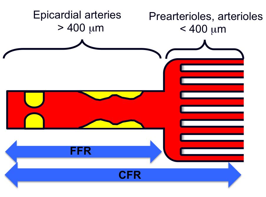 epicardial CAD, diffuse atherosclerosis, vessel remodeling and
