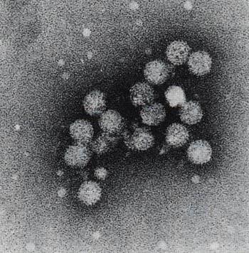 HEPATITIS C virus RNA virus, Flaviviridae family, hepacivirus RNA genome single strand, 9.