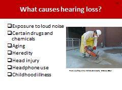 What causes hearing loss? NOTES FOR SLIDE 14 The most common cause of hearing loss is exposure to loud noises.