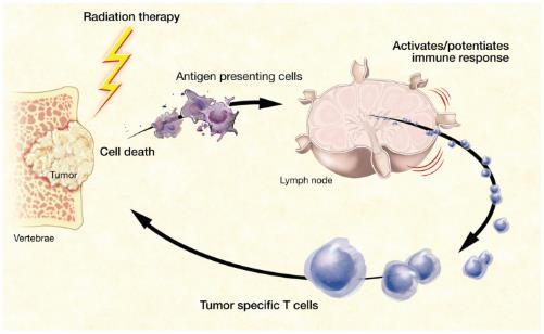 Radio-immunotherapy for Cancer Treatment Hodge, Guha,