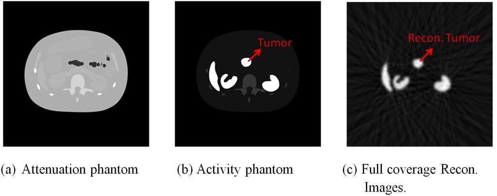 Figure 12: The XCAT phantom images of pancreas tumor case and its reconstructed tumor images. self-made tumor which only is shown in activity phantom.