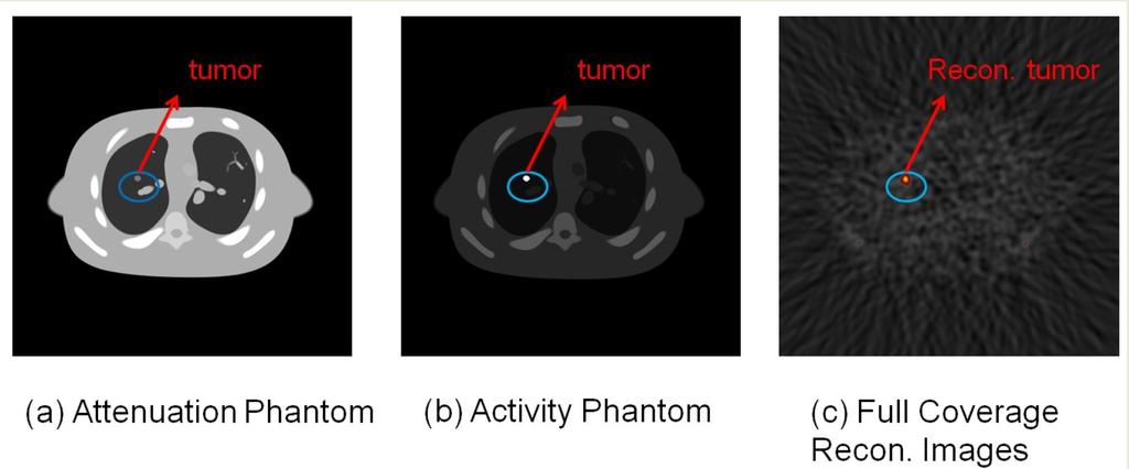 Figure 13: The XCAT phantom images of lung tumor case and its reconstructed tumor images. for IMRT planning according to routine clinical practice.