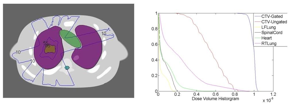 Figure 19: The locating accuracy of lung tumor case for full detector coverage. Figure 20: The locating accuracy of lung tumor case for 150 degree coverage.