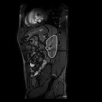 results for Kidney Alternating axial, coronal and