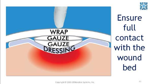 If the wound has any depth, apply Enluxtra, press it down with your finger, place folded gauze pads on top, and apply a wrap.