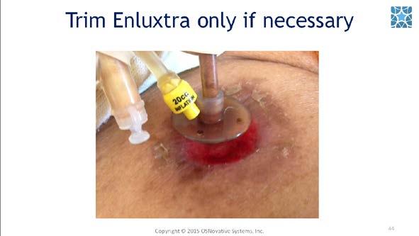 Trim Enluxtra: only if its edges interfere with