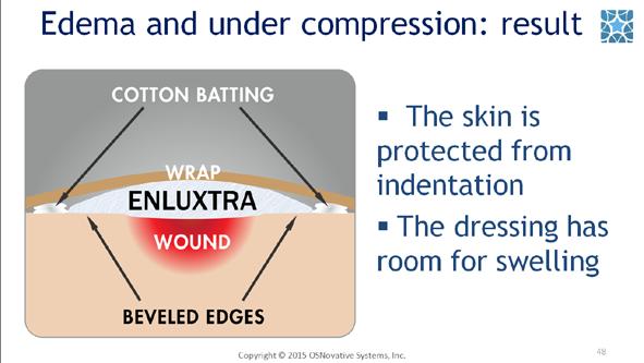 #48. Apply compression bandage.