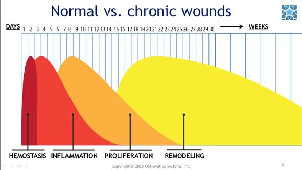#6. Normal healing process takes the wound from its appearance to complete healing through: hemostasis inflammation proliferation and remodeling stages.