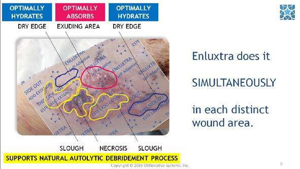 You can understand now that Enluxtra addresses every area of the wound separately, providing appropriate care for each specific location.