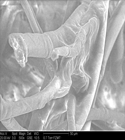 filter- or cobweb-effect ) (electron microscope):