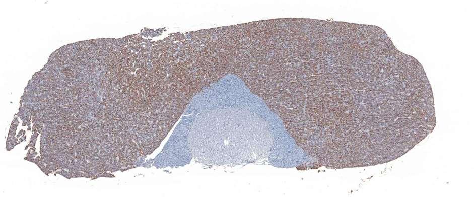 Pituitary Prolactin IHC in the female rat pituitary.