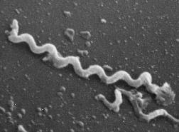 Microbiology Treponema pallidum Spiral shaped Spin around their long axis in a corkscrew manner. Cannot be cultured in vitro Cannot be viewed by normal light microscopy Pathogenesis Penetration: T.