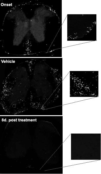 RTL551 Reverses T-cell Infiltration in Spinal Cords of Male and Female C57BL/6 Mice with EAE Onset 3