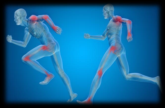 Osteoarthritis: We ve already covered Osteoarthritis. However, we ll do a quick recap. In simple terms, Osteoarthritis refers to inflammation of the joints.