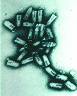 normal cells Vesicular stomatitis virus